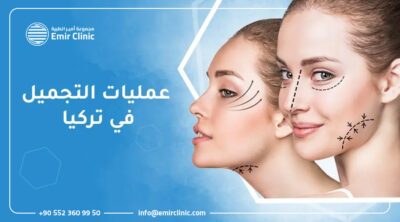 عمليات التجميل في تركيا