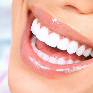 ابتسامة هوليوود في اسطنبول ابتسامة هوليوود في اسطنبول