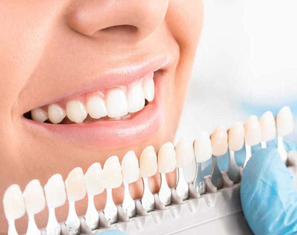 علاجات الأسنان في تركيا