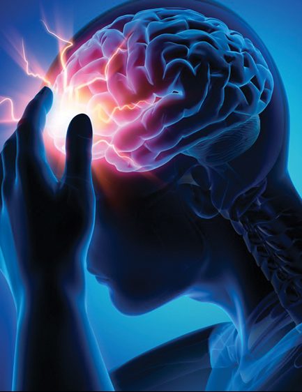 Stroke And Cerebral Angiography medical planet
