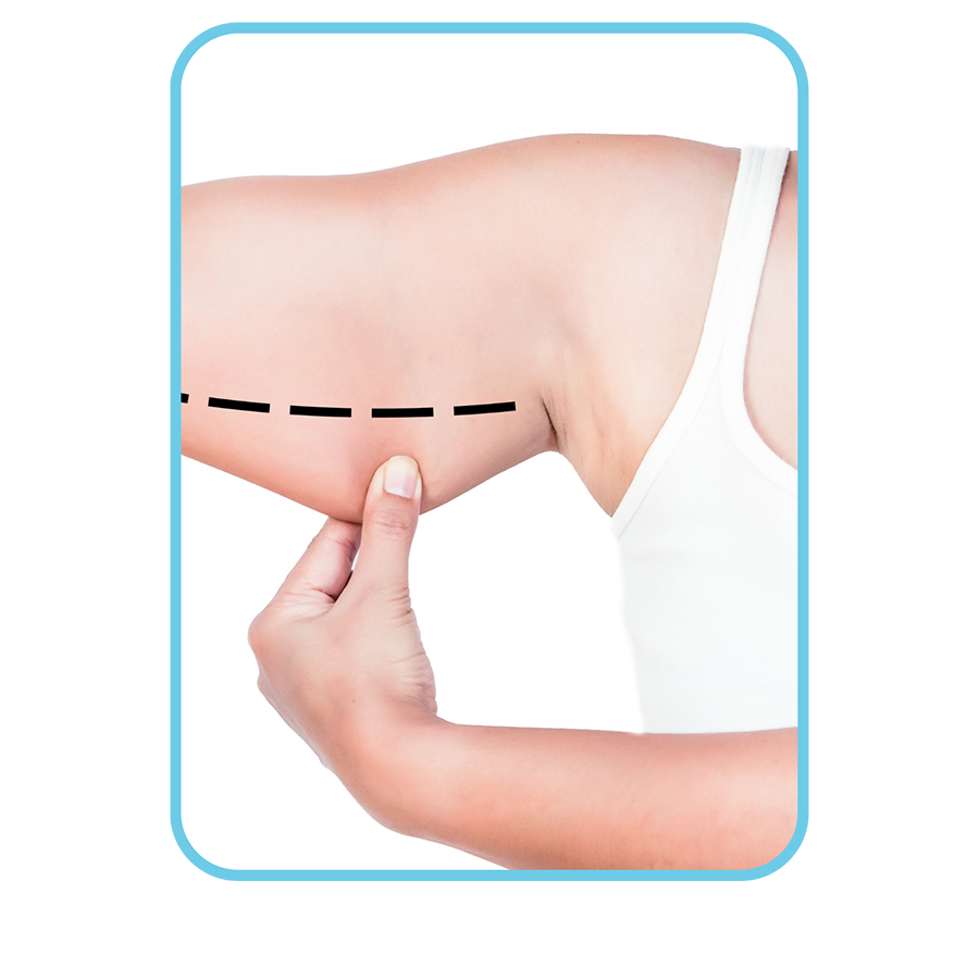 Upper Arm Aesthetics medical planet istanbul